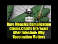Download Lagu Rare Measles Complication Claims Child’s Life Years After Infection: Why Vaccination Matters