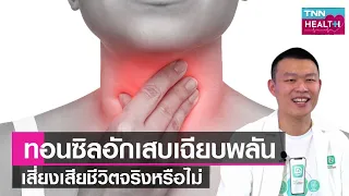  การรักษาต่อมทอนซินอักเสบมีวิธีใดบ้าง 