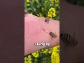 What Should You Do After A Bee Sting