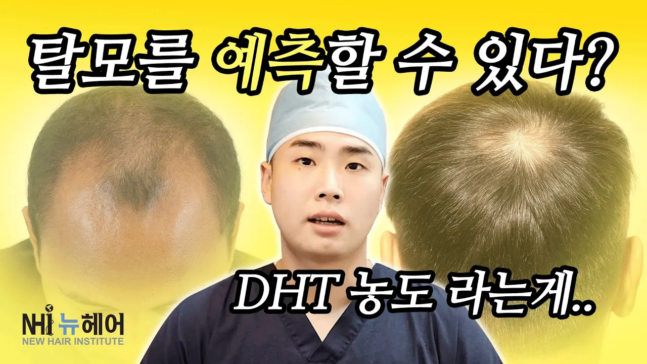 DHT 검사로 탈모를 미리 예측할 수 있을까? - 뉴헤어 I 탈모치료