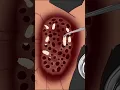 Download Lagu ASMR Treatment back #asmr #animation #satisfying #viral #trending #shorts