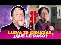 Adam Pearson responds to mockery of his deformed face