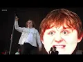 Lewis Capaldi - Forget Me (Story So Far Edit)