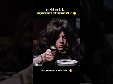 इस बच्चे की हालत देखकर आप भी हैरान रह जाएंगे! 😱 #Shorts