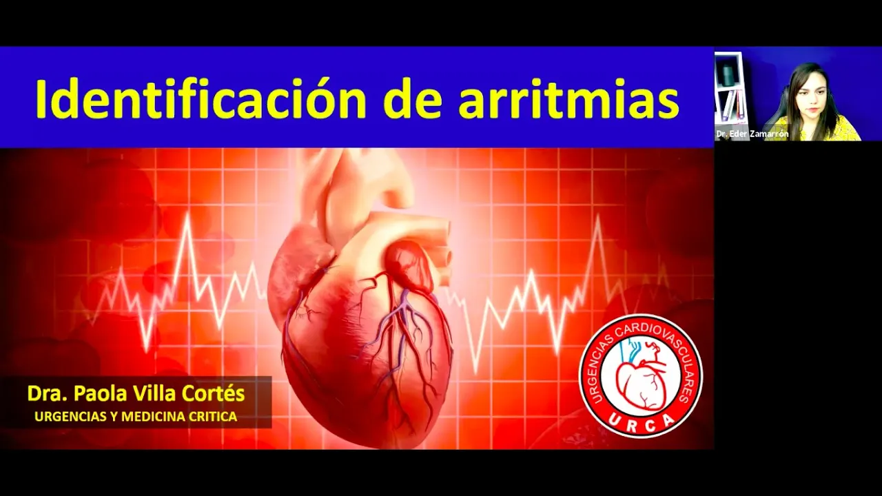 Identificación y abordaje de arritmias en áreas críticas By URCA