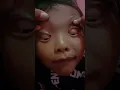 Download Lagu akibat anak kecil sering lihat hp matanya bisa berputar