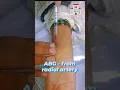 How to Take a Radial Arterial Blood Gas (ABG) Sample\