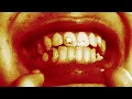 Fred again.. & Amyl and The Sniffers - you’re a star (perfectly sped up, reverb and distorted)