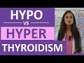 Hypothyroidism vs Hyperthyroidism Nursing NCLEX Hypothyroidism and Hyperthyroidism Difference