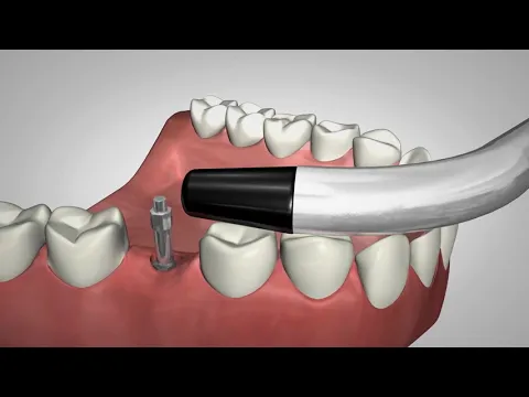 product video thumbnail