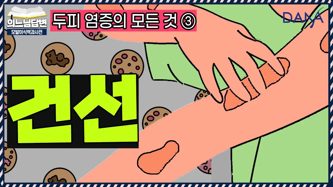의느님답변📂건선이란 무엇일까요?ㅣ두피 염증의 모든 것③ - 건선ㅣ다나성형외과(DANA)ㅣ모발이식ㅣ헤어라인교정ㅣ두피문신ㅣ탈모치료