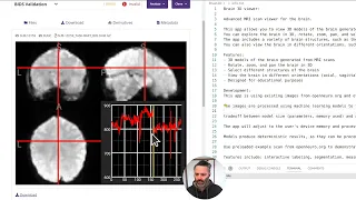 Exploring Open Source Brain MRI Data with Python Building a 3D MRI Viewer Using Flask