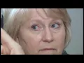 Ophthalmology basic exam ocular motility examination