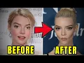Hollywood s Biggest Beauty Regret 8 Celebrities RUINED by Buccal Fat Removal
