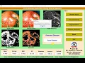 Matlab Code for FRUIT DISEASE DETECTION Using NEURAL NETWORK Full Source Code Project