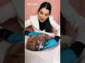 Fetus Model of the Amniotic Sac which is mostly filled with baby pee - Doctor Reacts