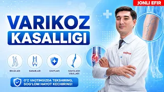 Варикоз касаллиги