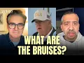 Download Lagu 'The Trump Health Cover-Up': How the Media Is COMPLICIT in a Huge Scandal