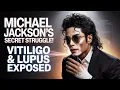 Download Lagu ''Michael Jackson's Secret Battle with Vitiligo and Lupus What the World Didn’t Know\