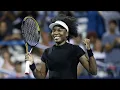 Venus Williams Shares Her One Condition for Getting Plastic Surgery