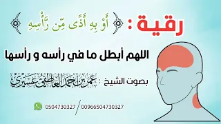 رقية لإبطال مافي الرأس أو به أذى من رأسه اللهم أبطل ما في رأسه و رأسها عمر العاطفي 