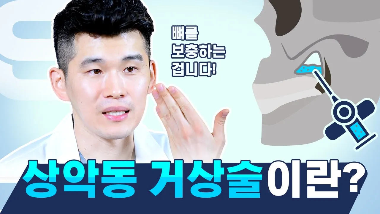 임플란트 진행 시 상악동거상술이란? 치과의사가 알려드립니다.