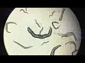 C elegans Movement Under Microscope The Effects of Alcohol