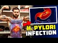 Gordon Ryan s Stomach Problems And 50 Of The WORLD Being Infected By H Pylori