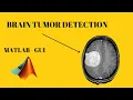 Brain Tumor Detection using Segmentation Matlab GUI Image Processing