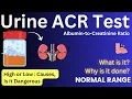 Urine ACR Test Albumin Creatinine Ratio Test Microalbumin to Creatinine Level Lab Test