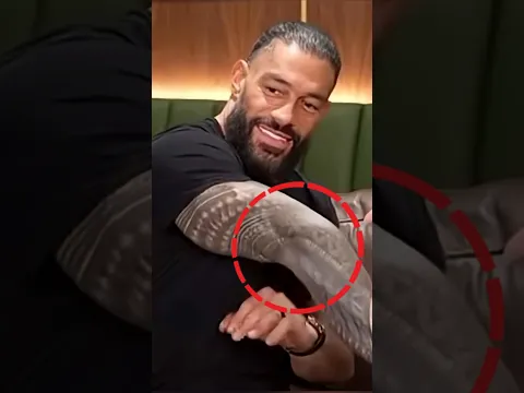 What Happened To Roman Reigns Hands
