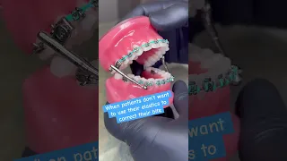 PSA use your elastics