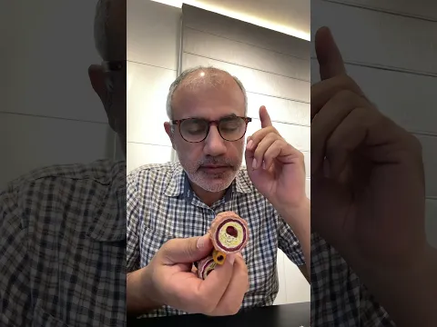 تشخيص تصلب الشرايين التاجية كيف؟ #وليدسرحان