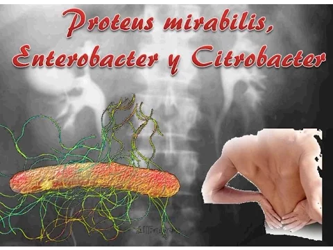 Download MP3 Proteus, Enterobacter y Citrobacter