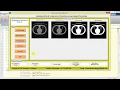 Lung Cancer Detection and Classification Using Image Processing Matlab Project with Source Code