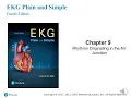 Chapter 9 Rhythms Originating in the AV Junction Lecture part II