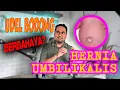 Download Lagu Udel bodong berbahaya? Ini hernia umbilikalis!
