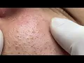Satisfying and Relaxation with SURI NGUYEN Beauty Spa