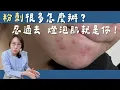 Download Lagu 擦A酸爆痘為什麼找上門？A醇不脫皮進階擦法！燈泡肌很簡單！