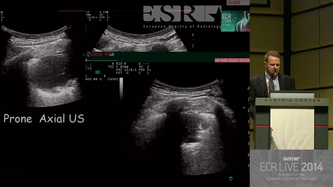 Chest - Needles and samples a practical approach to image guided biopsy