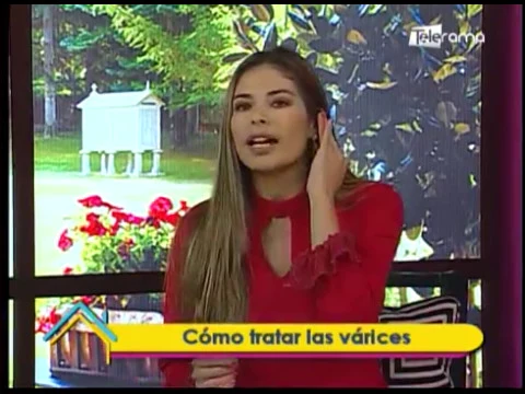 Dr. en Casa: Cómo tratar las várices 
