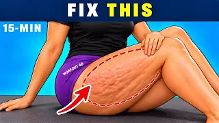 Day 3 of 6 | Dimples Behind Your Legs? Give Them 15 Minutes on the Carpet