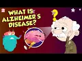 Download Lagu What Is Alzheimer's Disease? | Brain Disease | The Dr Binocs Show | Peekaboo Kidz