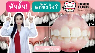  ฟันดูสั้นเกินไปควรรักษาอย่างไรบ้าง 
