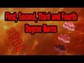 How To Grade BURNS - 1st 2nd 3rd and 4th Degree Burns Explained