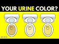 Download Lagu What The Color of Your Urine Says About Your Health