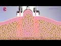 How Vacuum RF Fat Reduction Skin Tightening Treatment Work Slimming Lymphatic Drainage Machine