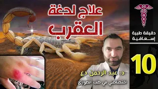 علاج لدغة العقرب   دندنها