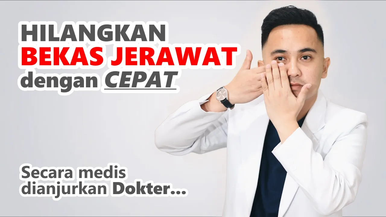 Menghilangkan jerawat menggunakan ES BATU !!. 