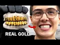Download Lagu Making custom gold grillz (to avoid crippling embarrassment)